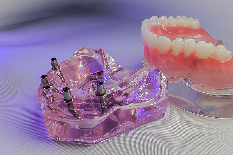 Same-day dental implant placement and immediate crown