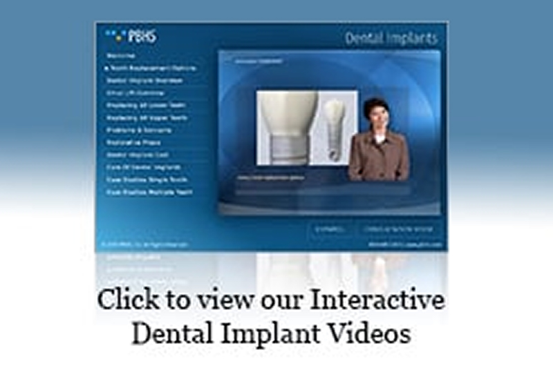 Patient after full mouth dental implant restoration